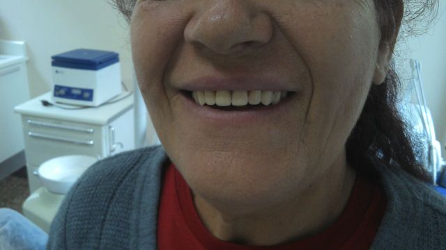 Paciente num momento de sorriso natural